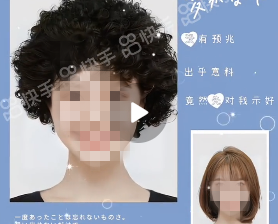 在快手做推广找代理商有哪些优势？