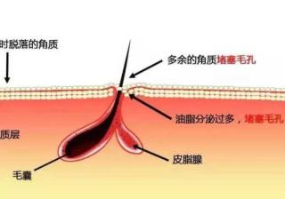 如何解救「大油田」？清爽男士必备的控油答案在此