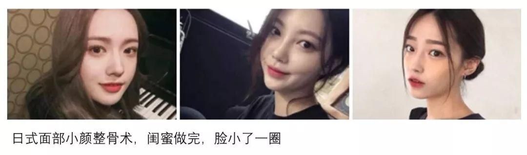 美柚女人通广告投放资源介绍及技巧！