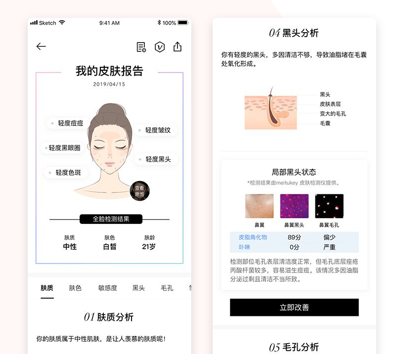 美拍广告公司meitukey皮肤检测仪正式开售填补家用市场空白 美拍广告公司meitukey皮肤检测仪正式开售填补家用市场空白