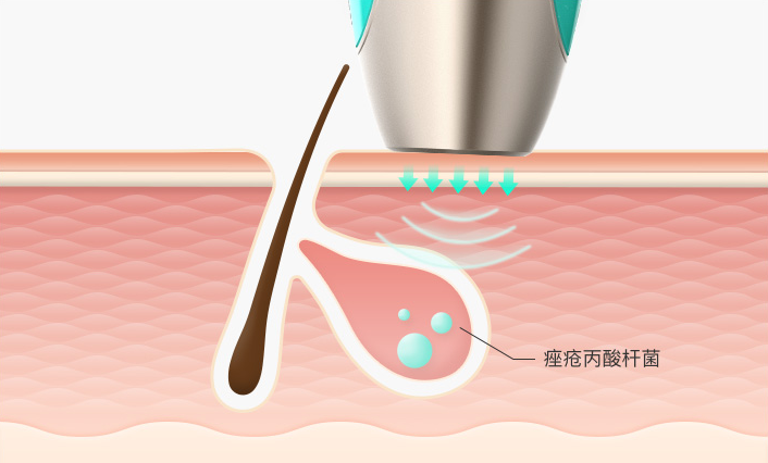 美拍广告公司meitukey皮肤检测仪正式开售填补家用市场空白 美拍广告公司meitukey皮肤检测仪正式开售填补家用市场空白