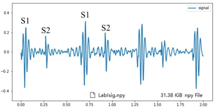 10-19：数字信号处理课程小结