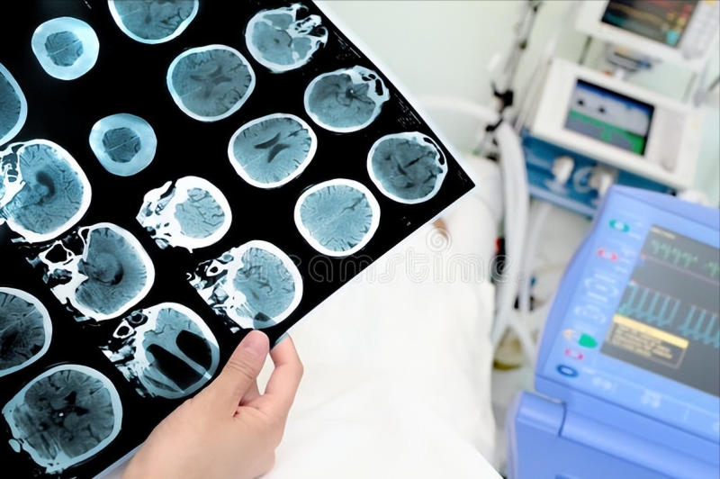 两位脑梗病人,一人扎手指头放血,一人拨打1 两位脑梗病人,一人扎手指头放血,一人拨打1